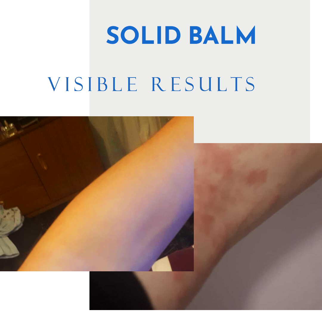 Soothe Solid Balm