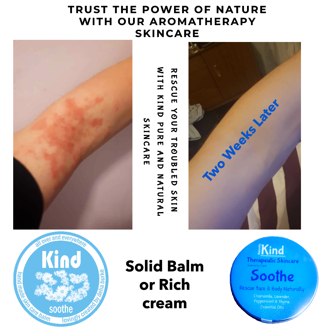 Inspired by Tiylan ~ Soothe